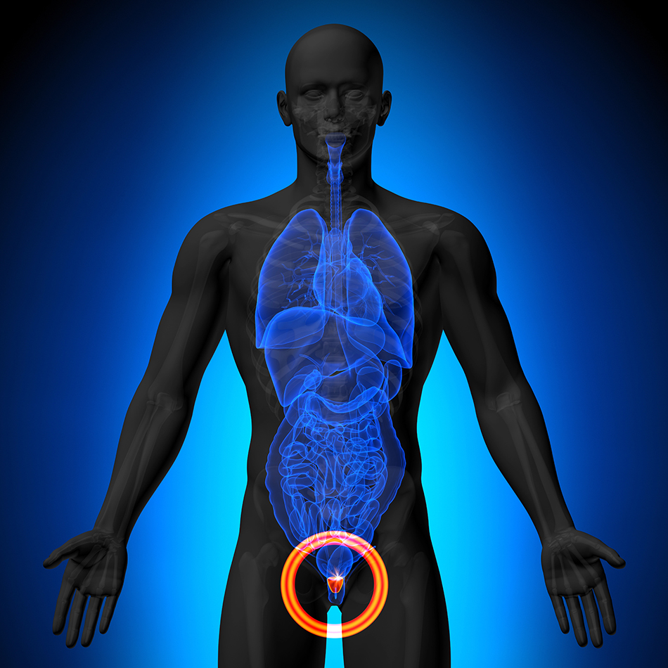 MRI-Solutions-helrygg MRI Solutions - prostata